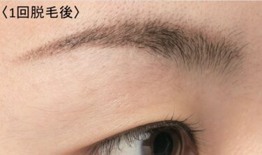 エステティックTBCの眉脱毛利用者数が約４０％増